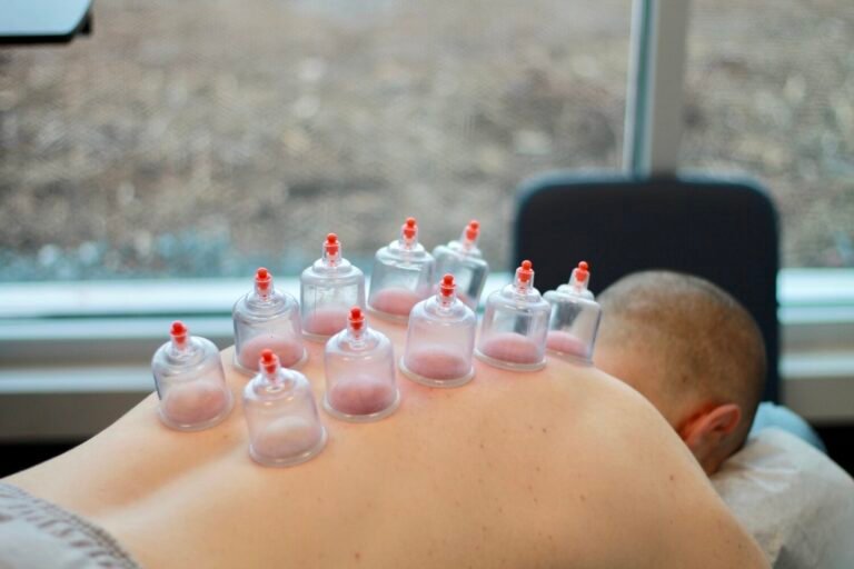 cupping